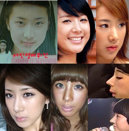 Korean actresses before and after plastic surgery.