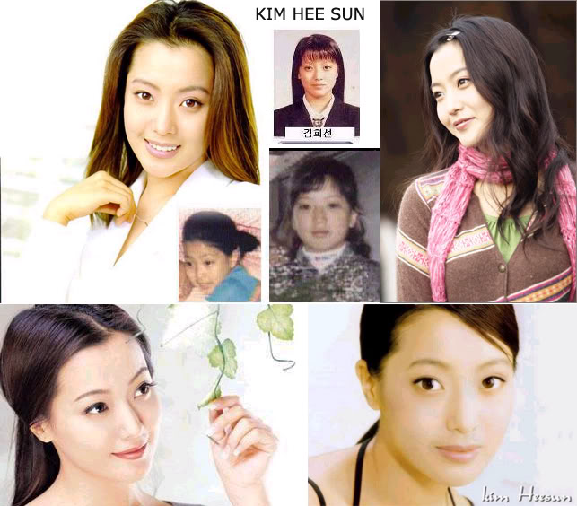 Korean actresses before and after plastic surgery.